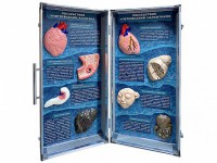 Учебно-демонстрационный кейс "Последствия употребления алкоголя и наркотиков" - fgospostavki.ru - Иркутск