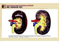 Рельефная таблица "Почка. Фронтальный разрез" (формат А1, матовое ламинирование) - fgospostavki.ru - Иркутск
