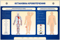 Электрифицированный стенд-тренажер "Остановка кровотечения" - fgospostavki.ru - Иркутск