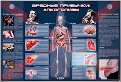 Электрифицированный стенд "Вредные привычки: алкоголизм" - fgospostavki.ru - Иркутск