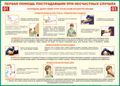 Таблица "Порядок действий при опасном кровотечении" (100х140 сантиметров, винил) - fgospostavki.ru - Иркутск