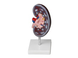 Модель почки в разрезе - fgospostavki.ru - Иркутск